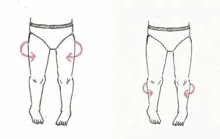 孩子走路内八字要不要管?怎么管?答案都在这儿了!