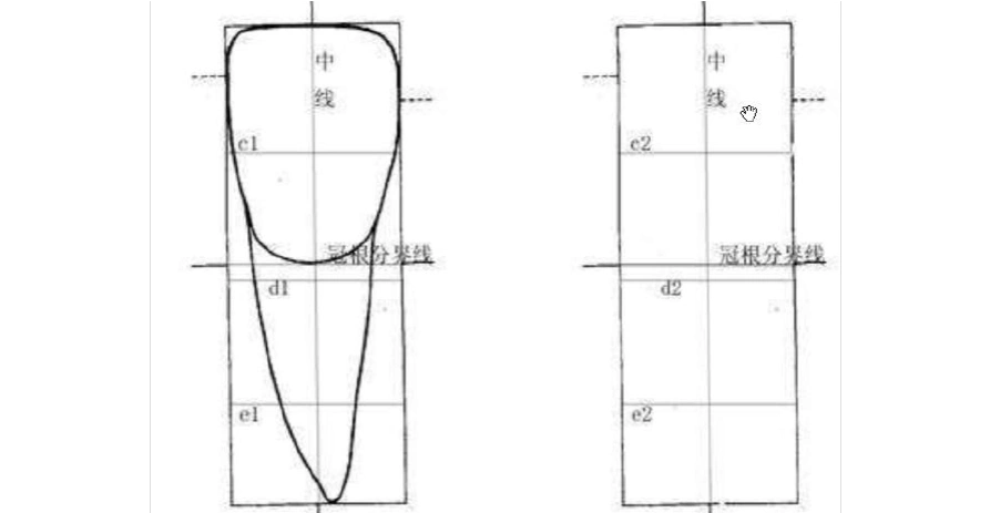 上颌中切牙雕刻图谱