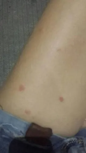 得艾滋病女人的图片