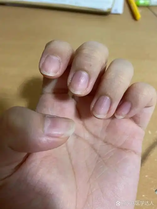 这种短宽指甲怎么养? 今天在评论里的,大部分都是这种指甲.