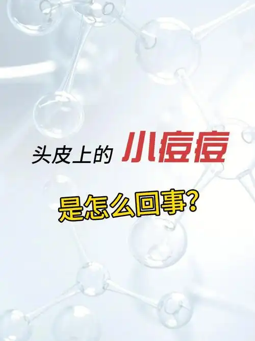 6015很多人以为是头上长"痘痘"了,其实这是毛囊炎的典型症状.