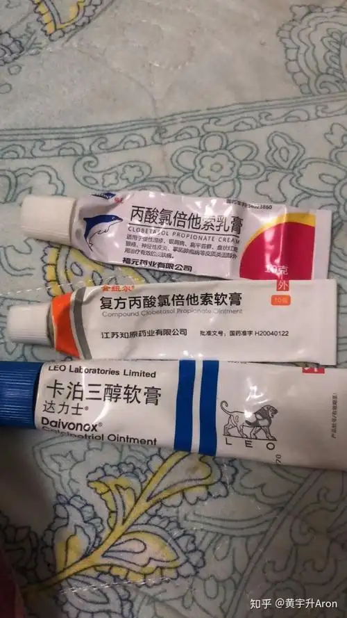 复方丙酸氯倍他索乳膏对牛皮癣有效果吗? - 知乎