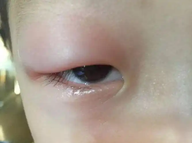 com)育儿有方法 你问我来答问题一我家女宝宝7个多月,最近早上醒来