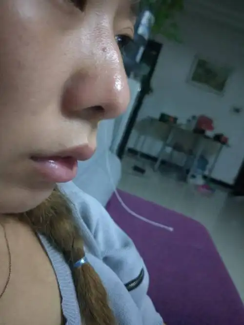 这是怎么回事啊!为什么鼻子是黑的