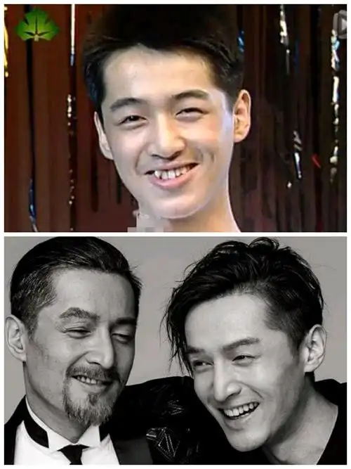 男神胡歌当初也因为一口牙不整齐且略龅牙给精致立体的五官减分不少