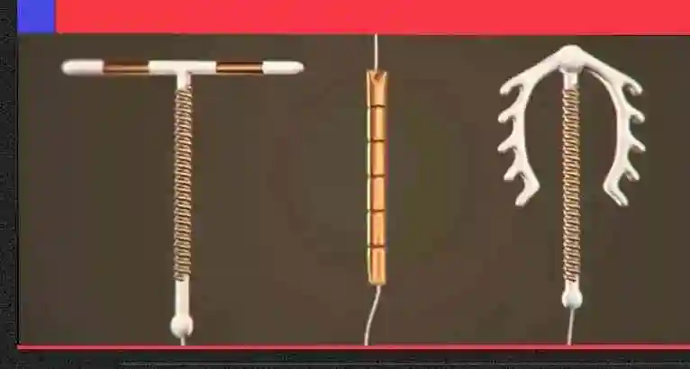 用过的姐妹来说说选择哪种避孕环效果最好