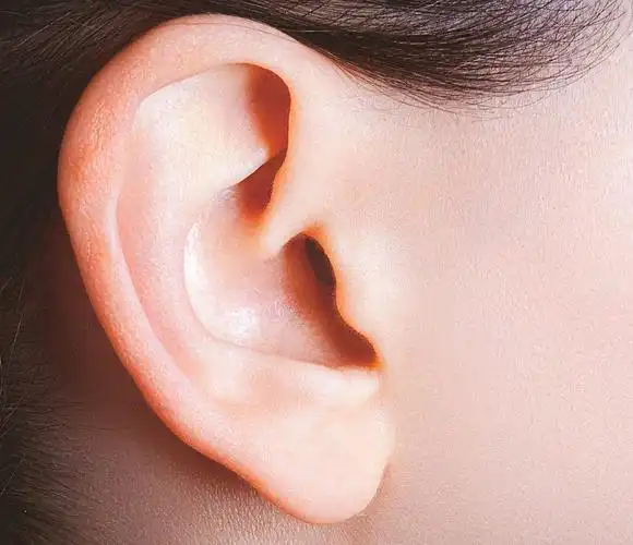 上海薇琳菜花耳整形,还原耳朵正常形态