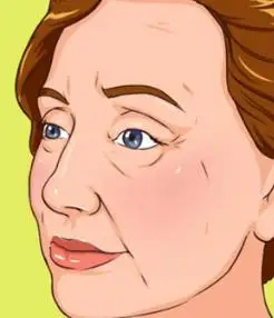 短时间内减少,已经被撑开的皮肤无法适应收缩,会引起皮肤松弛的问题