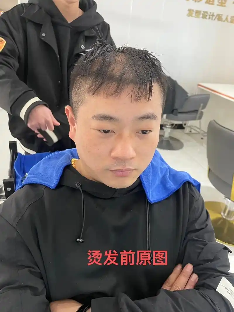 头顶发量稀少看过来.#头顶发量少 #男士发型  #懂你的发型 - 抖音