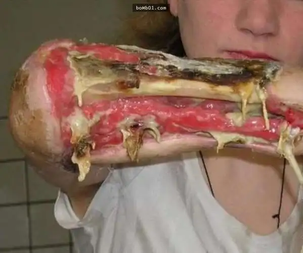 这个世界上最可怕的毒品会让人彻底变成「活尸」,从外部开始腐烂的