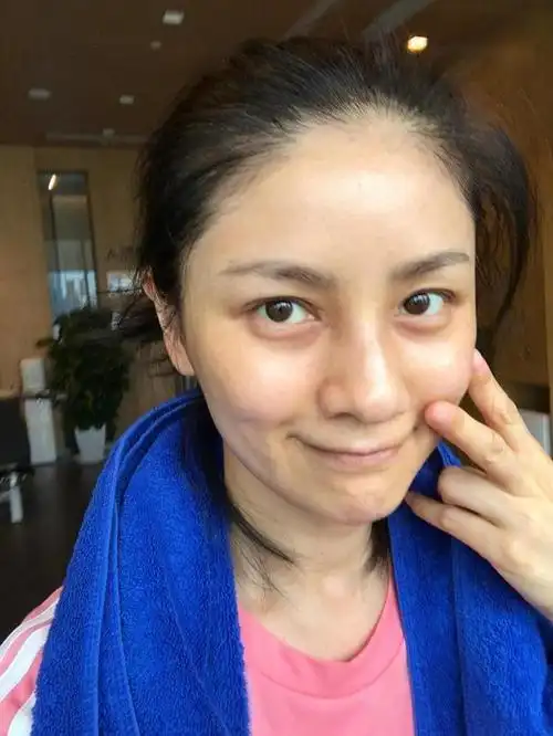 胡可晒素颜照皮肤蜡黄眼窝深真实不做作