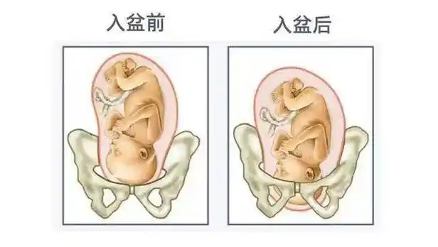 b超检查能看到胎儿"入盆"吗?_骨盆_超声_宝宝