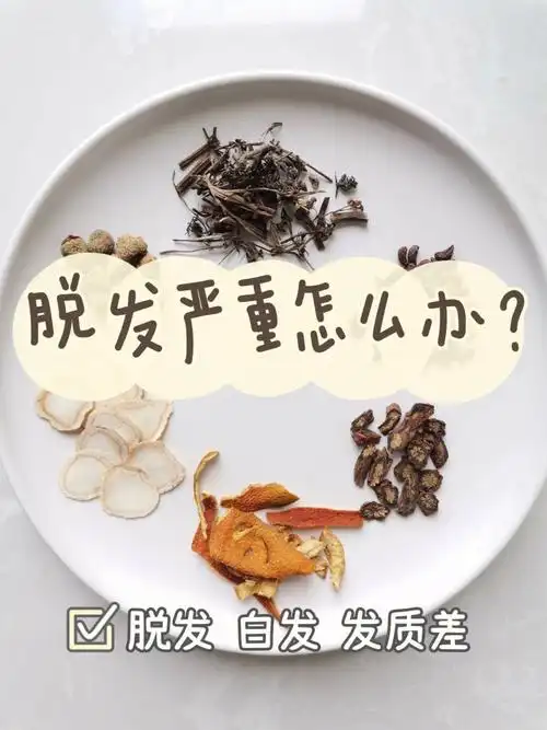 脱发严重怎么办用对了方法轻松缓解