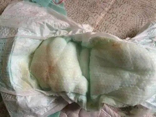 9个月宝宝体内激素过多纸尿裤上竟有红色分泌物