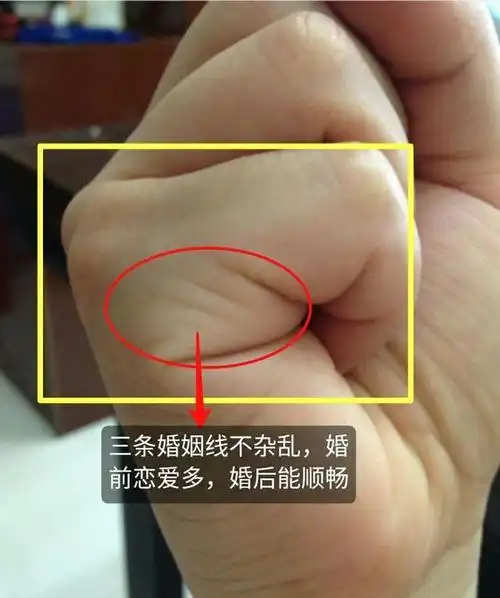 婚姻线数量多寡杂乱长短决定婚恋的成败