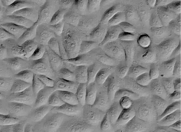 人毛囊角质细胞