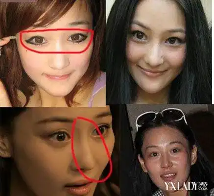 张馨予整容前照片