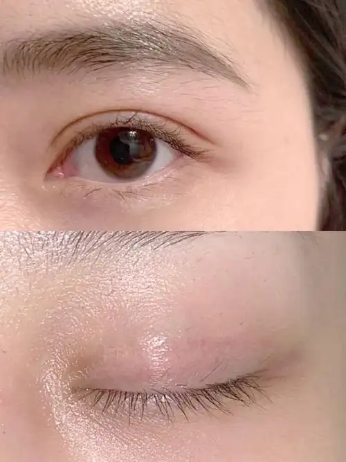 效果超出预期,解答全面,专业,值得信赖,设备,设备_圈子-新氧美容整形