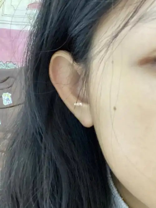 有跟我一样的吗耳朵薄薄的没有轮廓