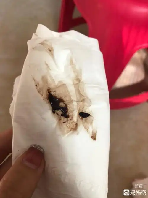 腔再由子宫颈经阴道流出对有排卵的妇女于月经中期检查宫颈管粘液时