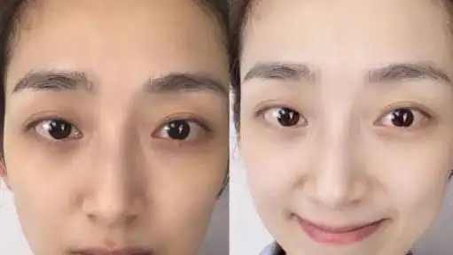 李佳琦多次推荐的美白精华,美白淡斑祛暗沉,网友:用着真心不错