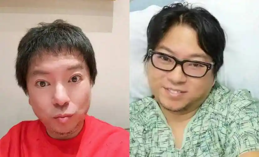 53岁高晓松晒近照暴瘦,网友直呼认不出,疑过度医美撞脸华晨宇_减肥