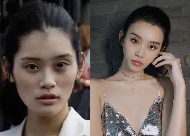 跟王子文学习面部填充大变活人实现逆龄神话