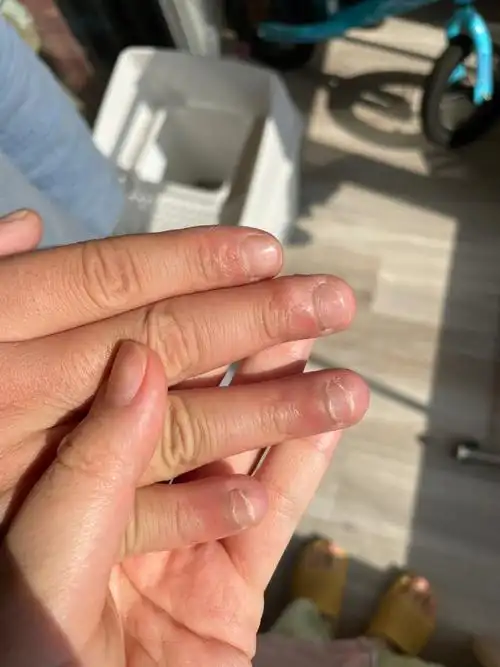 老公快30了爱咬指甲