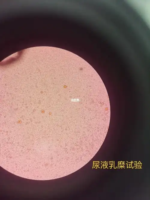 乳糜试验