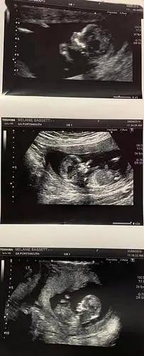 其中一侧是一对双胞胎女宝宝,另一侧是男宝宝.