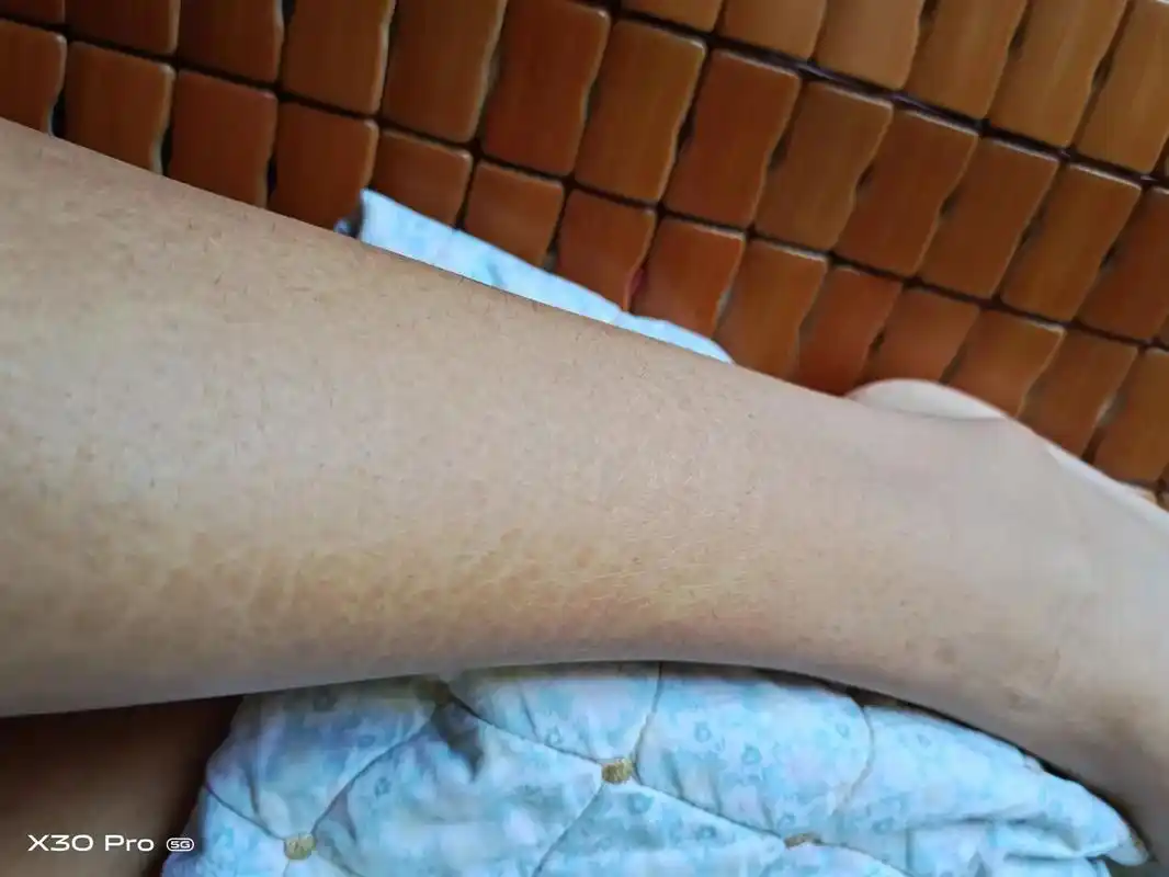 鱼鳞皮肤日常洗澡.