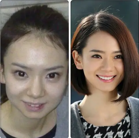 戚薇整容似变脸整容前后差距巨大