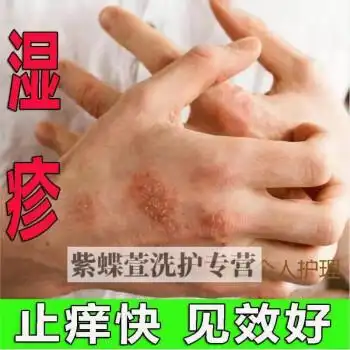 蛇胆清l毒草本乳膏过敏成人止痒膏皮肤瘙痒湿l疹牛皮l藓膏单瓶装