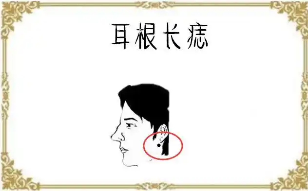 身上5颗小人痣留不得是非不断麻烦缠身好日子也会变穷