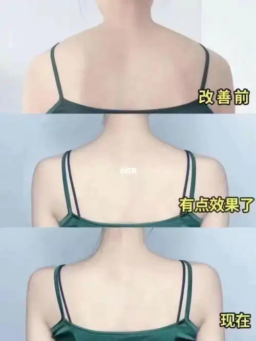 95瘦肩針91打的是气质98 脖子短,虎背熊腰都是因为 斜方肌发达