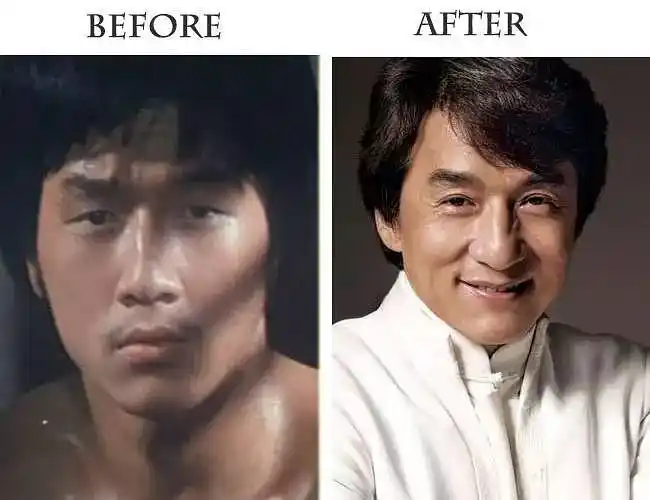 明星们的眼皮变化  在娱乐圈中,有不少单眼皮的女星男星们选择了双