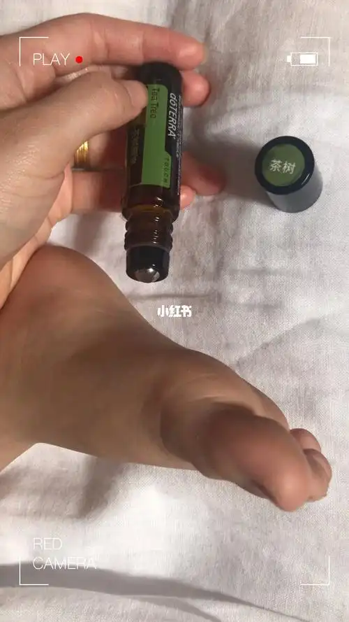 开学了给孩子脚底后背抹抹油增强抵抗力