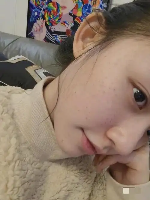 11月13日,林允分享打水光针的视频,网友看后表示佩服|周星驰|容嬷嬷