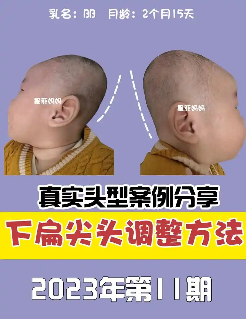 创作灵感 下扁尖头该如何睡出小圆头71#宝宝头型 #头型睡扁 - 兑趑