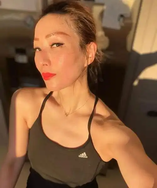 使唔使去到咁尽48岁郑秀文分享背部刮痧照片惹关注