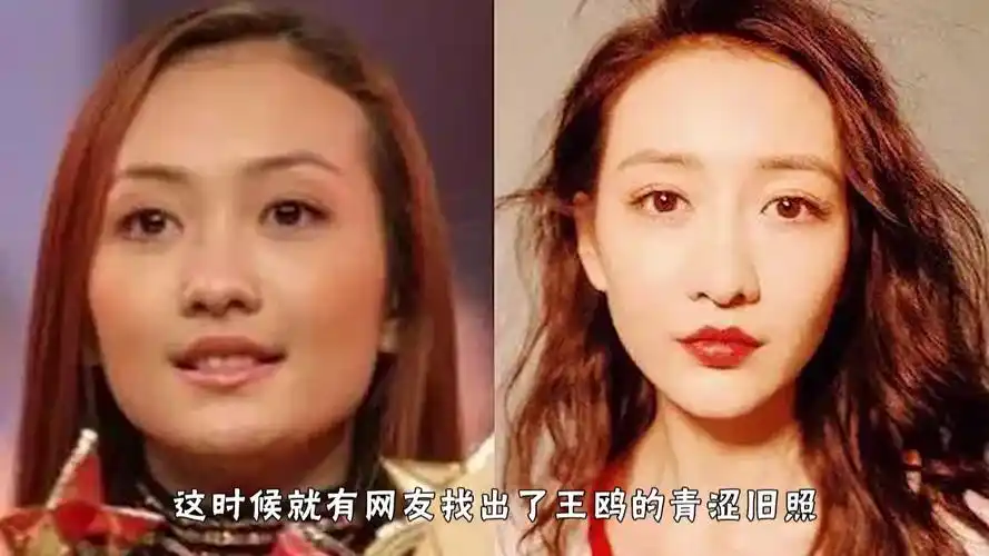王鸥疑似暴露整容后遗症,腮帮时大时小,脸型奇怪被吐槽像个芒果
