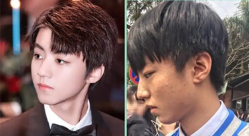 痘痘消了王俊凯更帅了怎么做到的呢