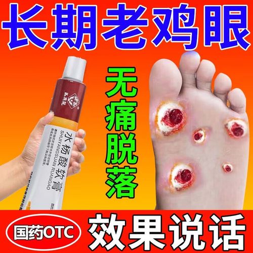1盒【基础装】鸡眼瘊子去除肉刺药膏