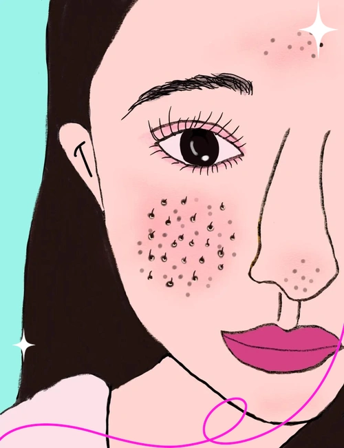 毛孔粗大?试试这4个实用方法!