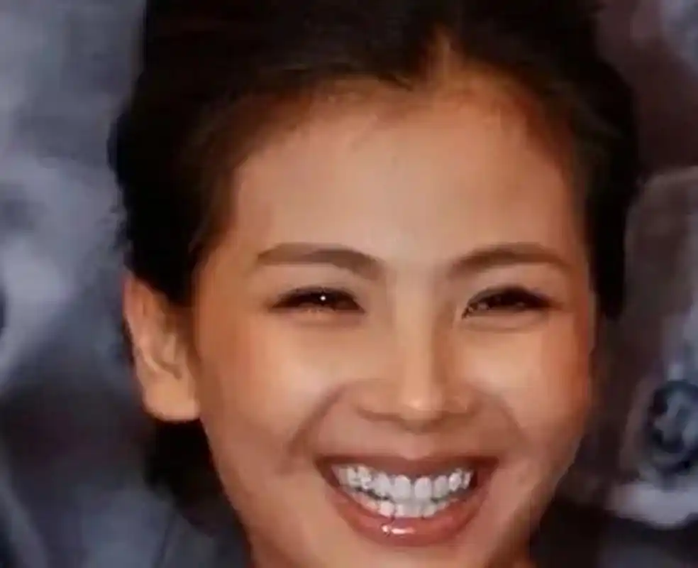 刘涛为了美,拔光了所有的牙齿,花300万装烤瓷牙后,却让她的肠子都悔青