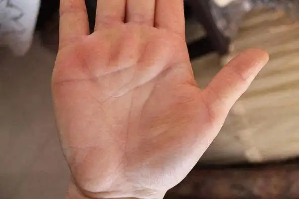 陈平命理手相中手掌生命线断开意味着什么