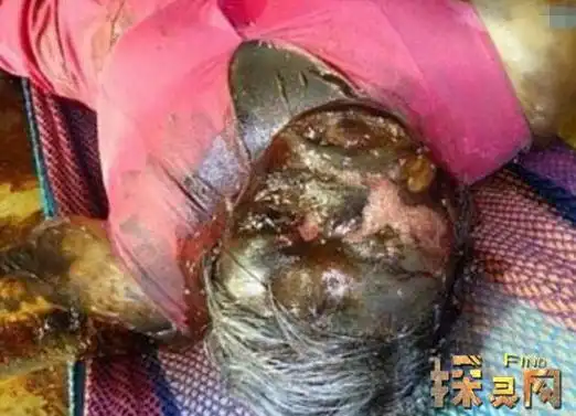 尸体腐败现象人死后尸体会膨胀流出绿色液体令人反胃2
