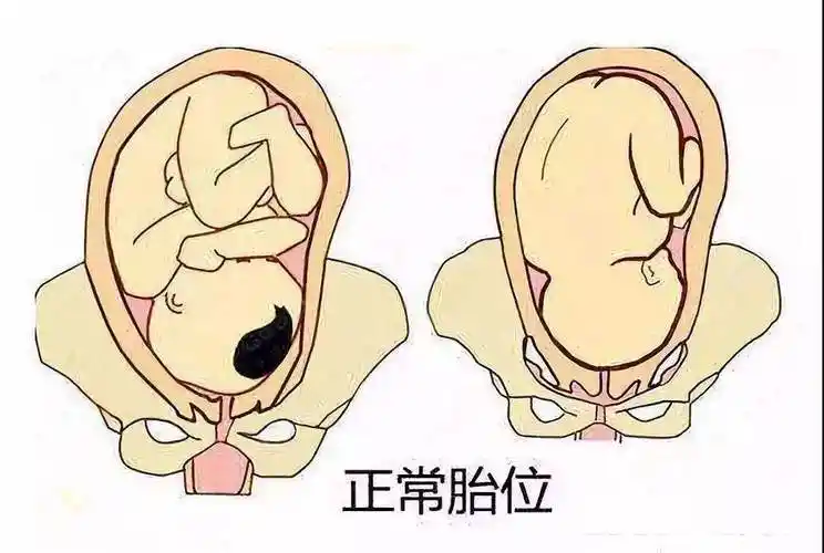 颜无痕小课堂胎儿横位的妈妈该怎么睡觉