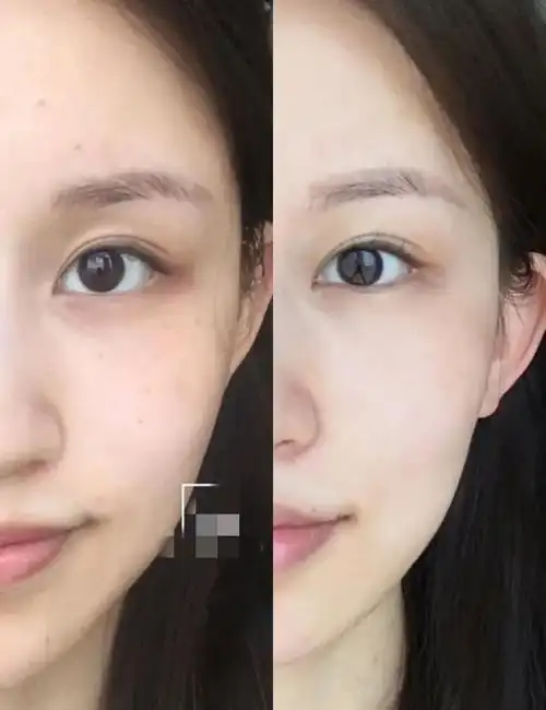 贝嫂自曝9年每周必须用2次拯救熬夜脸直击暗沉一夜焕颜黄气退散