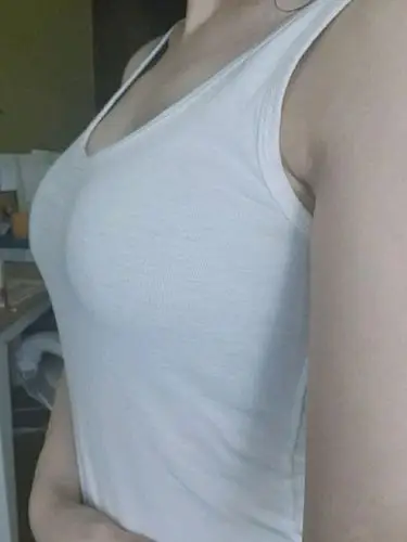 04隆胸亲身经历分享7515 自从青春期开始发育,00胸没_圈子